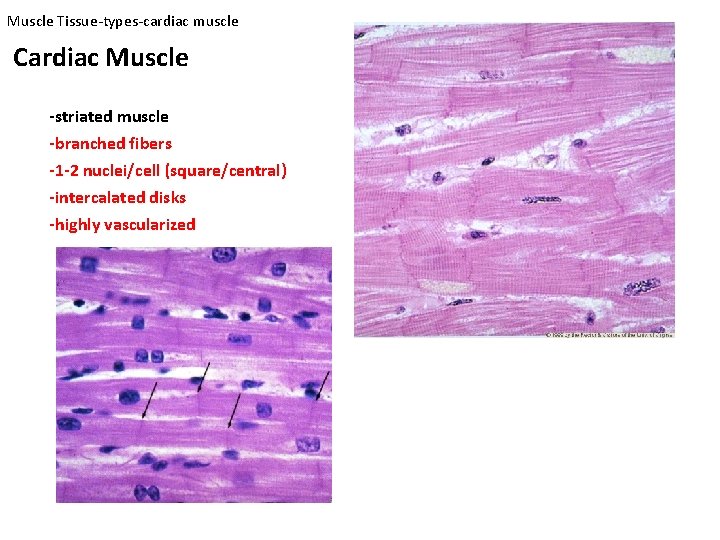 Muscle Tissue-types-cardiac muscle Cardiac Muscle -striated muscle -branched fibers -1 -2 nuclei/cell (square/central) -intercalated