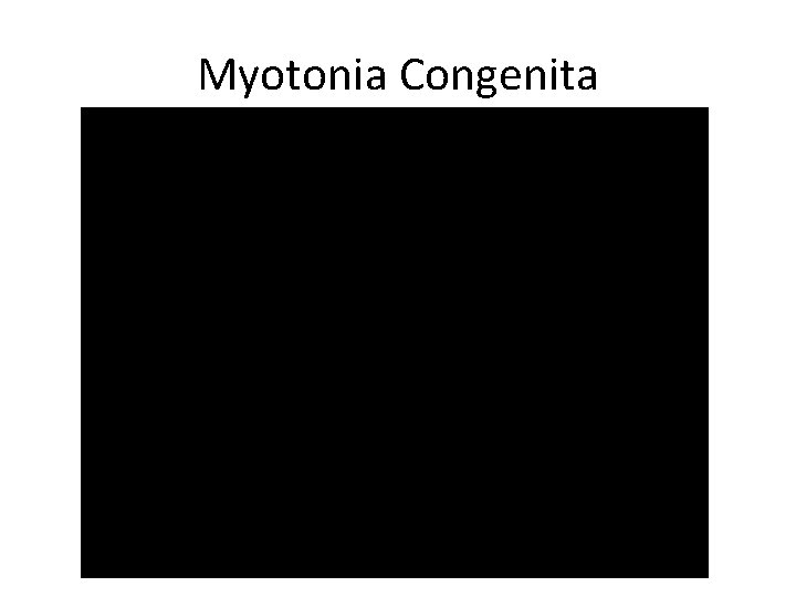 Myotonia Congenita 