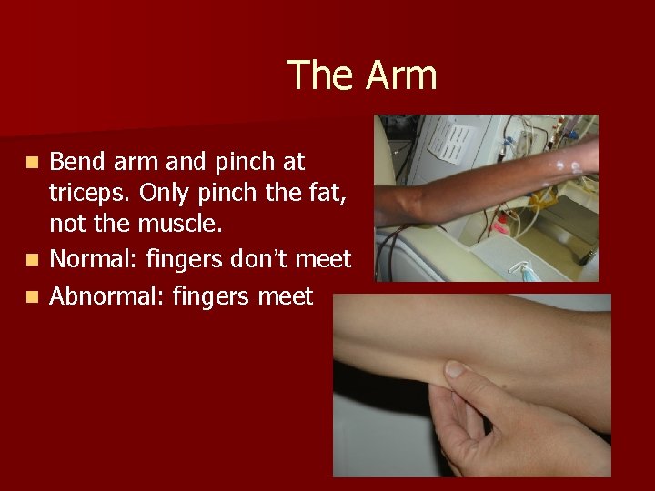 The Arm Bend arm and pinch at triceps. Only pinch the fat, not the
