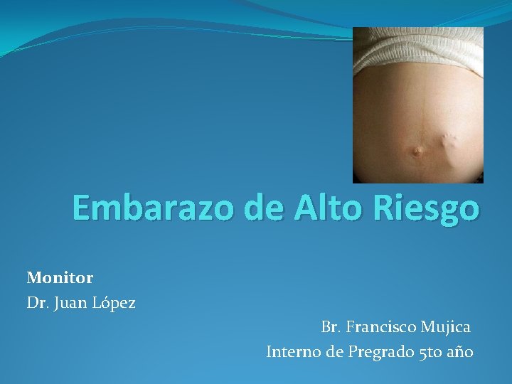 Embarazo de Alto Riesgo Monitor Dr. Juan López Br. Francisco Mujica Interno de Pregrado