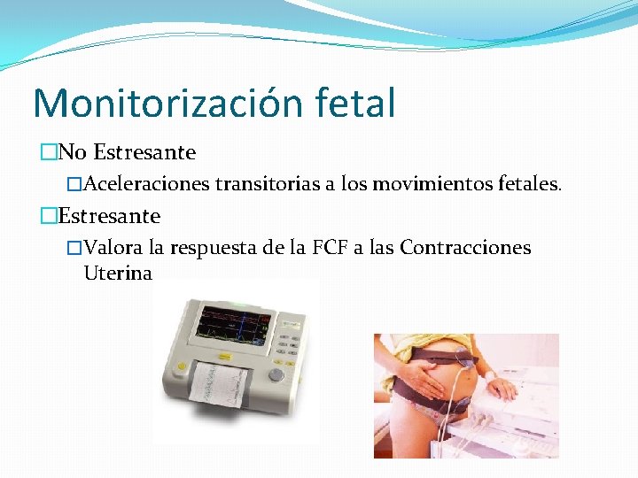 Monitorización fetal �No Estresante �Aceleraciones transitorias a los movimientos fetales. �Estresante �Valora la respuesta