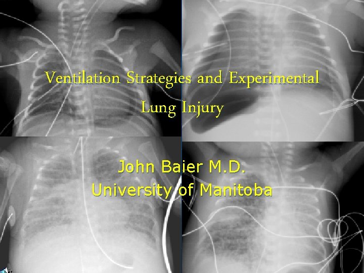 Ventilation Strategies and Experimental Lung Injury John Baier M. D. University of Manitoba 