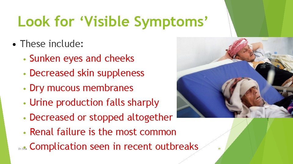 Look for ‘Visible Symptoms’ • These include: • Sunken eyes and cheeks • Decreased