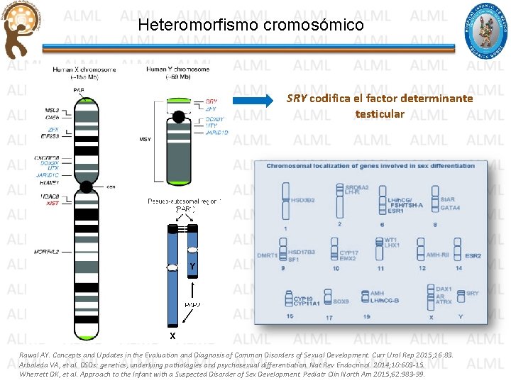 Heteromorfismo cromosómico SRY codifica el factor determinante testicular Rawal AY. Concepts and Updates in