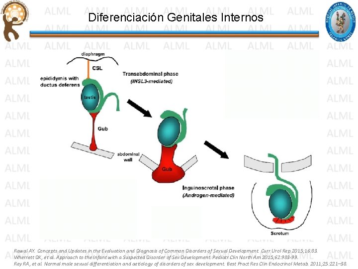 Diferenciación Genitales Internos Rawal AY. Concepts and Updates in the Evaluation and Diagnosis of