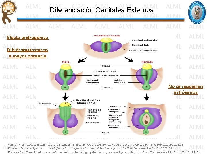 Diferenciación Genitales Externos Efecto androgénico Dihidrotestosteron a mayor potencia No se requieren estrógenos Rawal