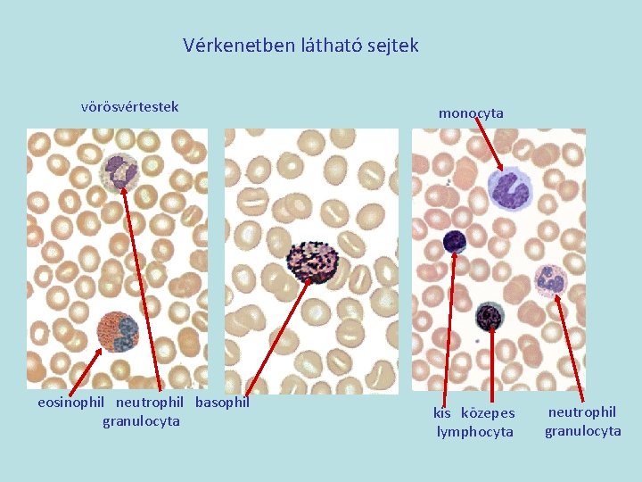 Vérkenetben látható sejtek vörösvértestek eosinophil neutrophil basophil granulocyta monocyta kis közepes lymphocyta neutrophil granulocyta