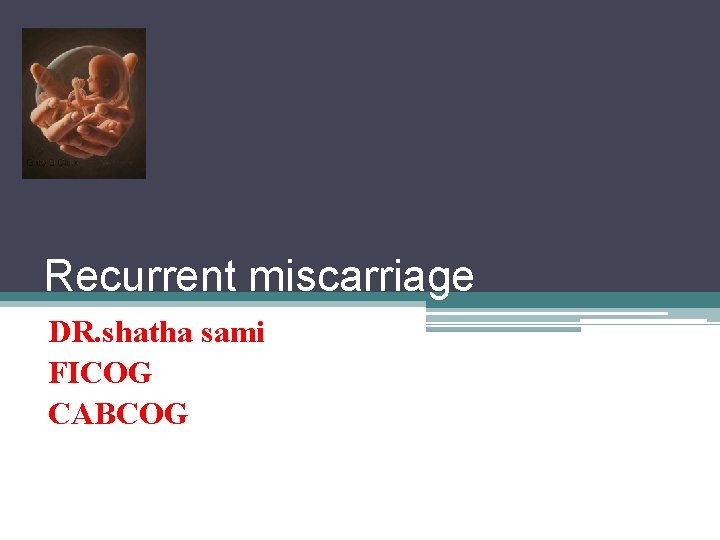 Recurrent miscarriage DR. shatha sami FICOG CABCOG 