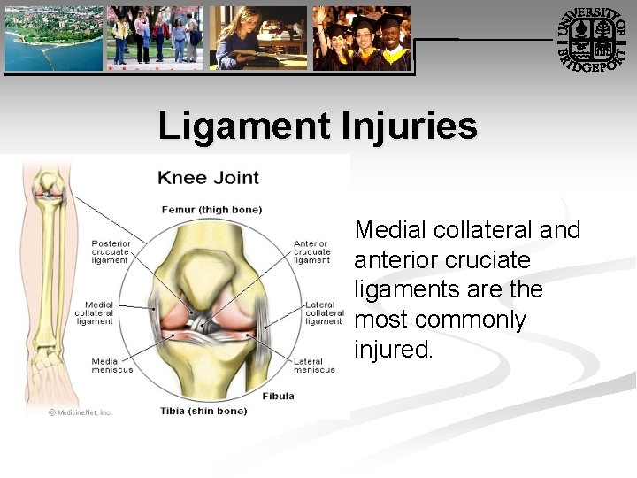 Ligament Injuries Medial collateral and anterior cruciate ligaments are the most commonly injured. 