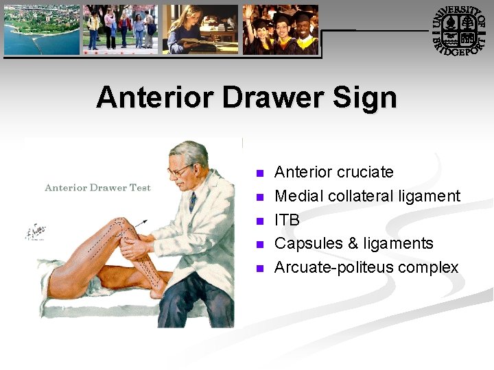 Anterior Drawer Sign n n Anterior cruciate Medial collateral ligament ITB Capsules & ligaments