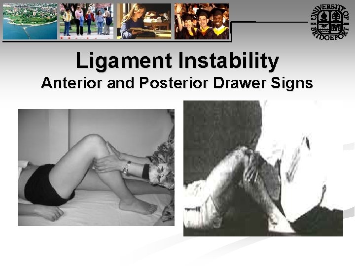 Ligament Instability Anterior and Posterior Drawer Signs 