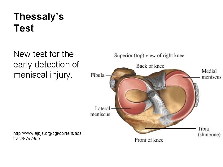 Thessaly’s Test New test for the early detection of meniscal injury. http: //www. ejbjs.