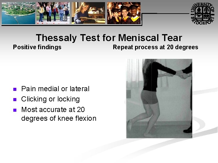Thessaly Test for Meniscal Tear Positive findings n n n Pain medial or lateral