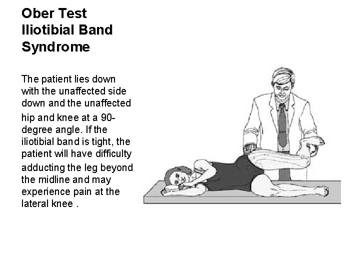 Ober Test Iliotibial Band Syndrome The patient lies down with the unaffected side down