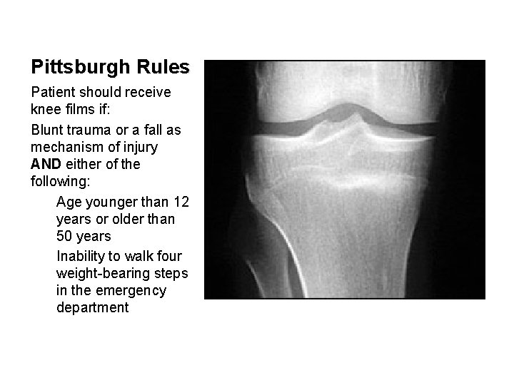 Pittsburgh Rules Patient should receive knee films if: Blunt trauma or a fall as