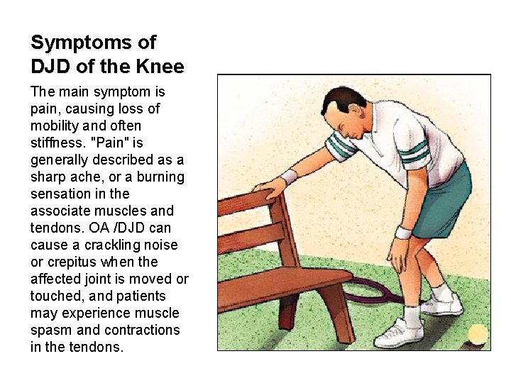 Symptoms of DJD of the Knee The main symptom is pain, causing loss of