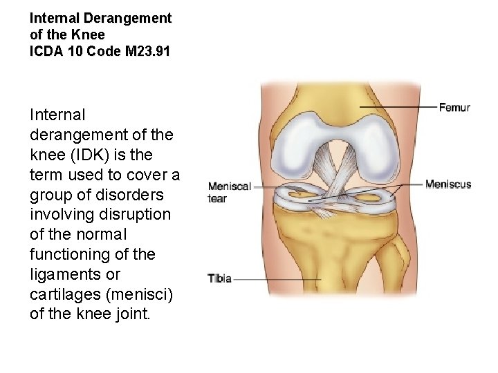 Internal Derangement of the Knee ICDA 10 Code M 23. 91 Internal derangement of