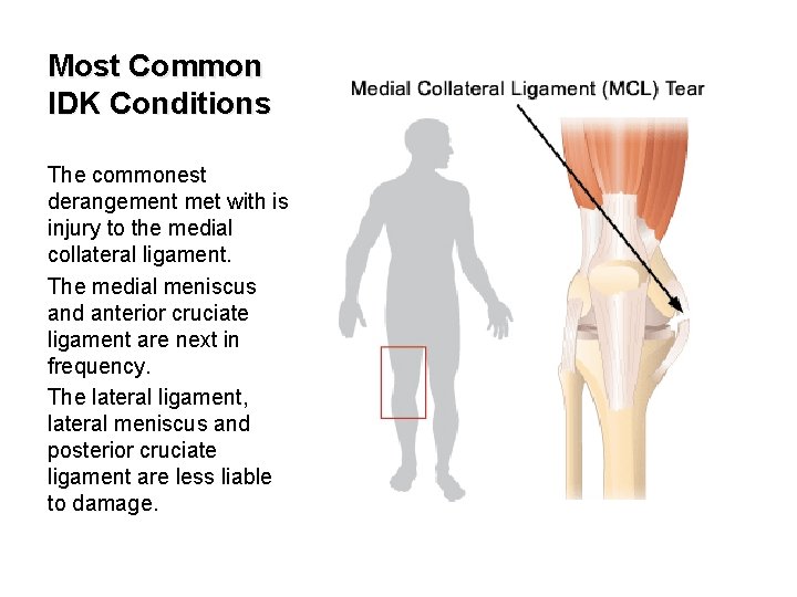 Most Common IDK Conditions The commonest derangement met with is injury to the medial