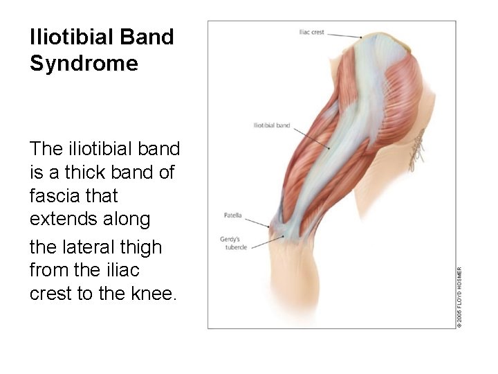 Iliotibial Band Syndrome The iliotibial band is a thick band of fascia that extends