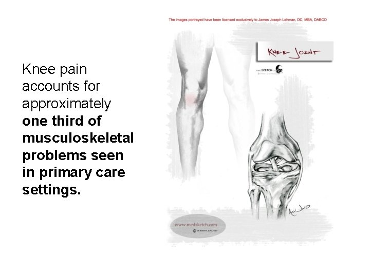 Knee pain accounts for approximately one third of musculoskeletal problems seen in primary care