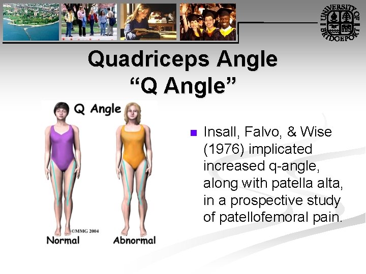 Quadriceps Angle “Q Angle” n Insall, Falvo, & Wise (1976) implicated increased q angle,
