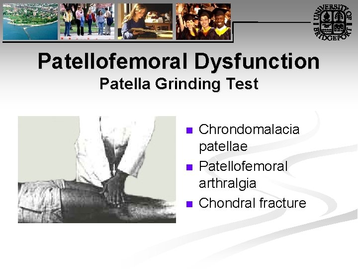 Patellofemoral Dysfunction Patella Grinding Test n n n Chrondomalacia patellae Patellofemoral arthralgia Chondral fracture