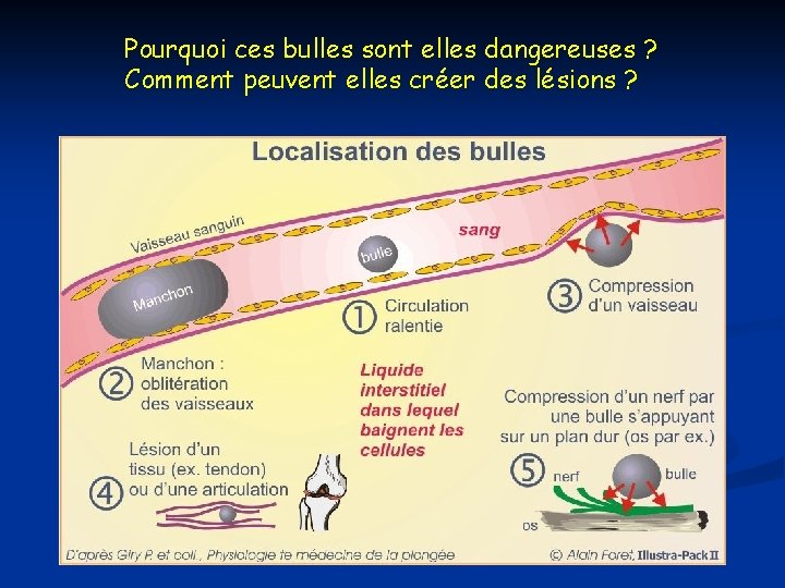 Pourquoi ces bulles sont elles dangereuses ? Comment peuvent elles créer des lésions ? Pourquoi ces bulles sont elles dangereuses ? Comment peuvent elles créer des lésions ?
