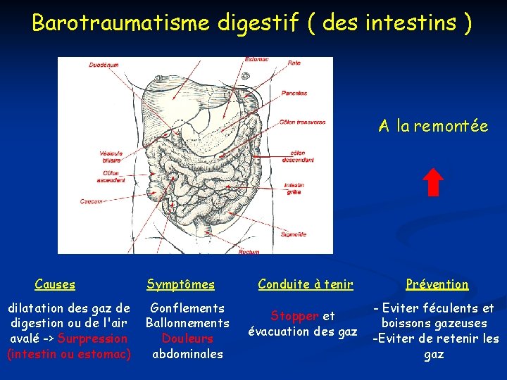 Barotraumatisme digestif ( des intestins ) A la remontée Causes dilatation des gaz de Barotraumatisme digestif ( des intestins ) A la remontée Causes dilatation des gaz de
