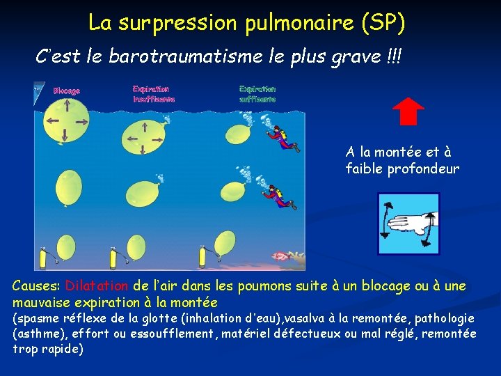 La surpression pulmonaire (SP) C’est le barotraumatisme le plus grave !!! A la montée La surpression pulmonaire (SP) C’est le barotraumatisme le plus grave !!! A la montée