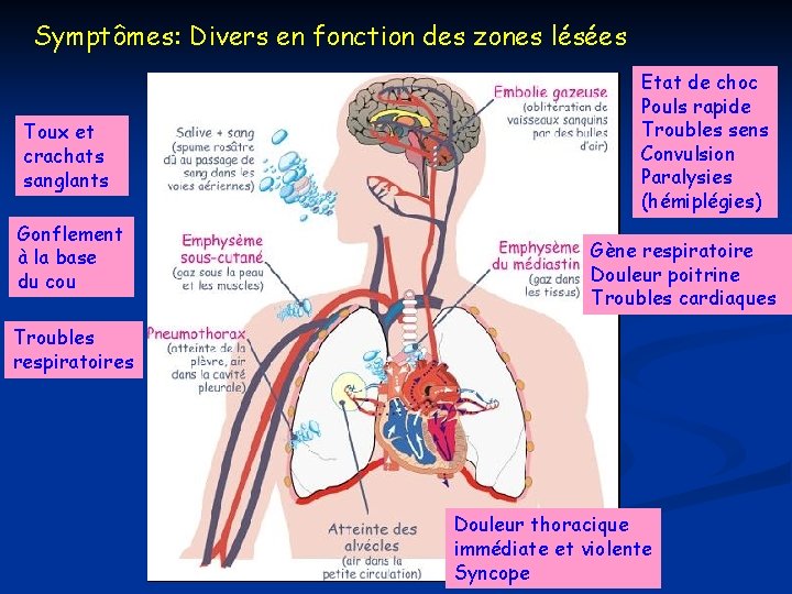 Symptômes: Divers en fonction des zones lésées Toux et crachats sanglants Gonflement à la Symptômes: Divers en fonction des zones lésées Toux et crachats sanglants Gonflement à la