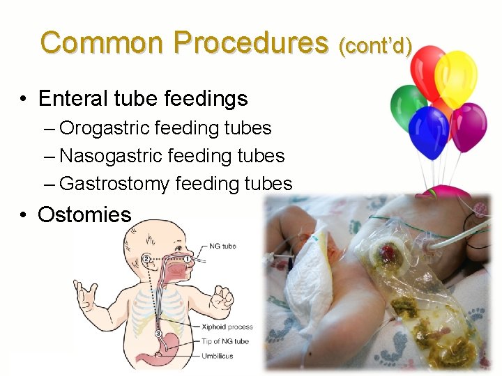 Common Procedures (cont’d) • Enteral tube feedings – Orogastric feeding tubes – Nasogastric feeding