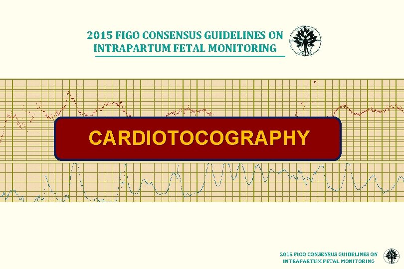 2015 FIGO CONSENSUS GUIDELINES ON INTRAPARTUM FETAL MONITORING CARDIOTOCOGRAPHY 2015 FIGO CONSENSUS GUIDELINES ON