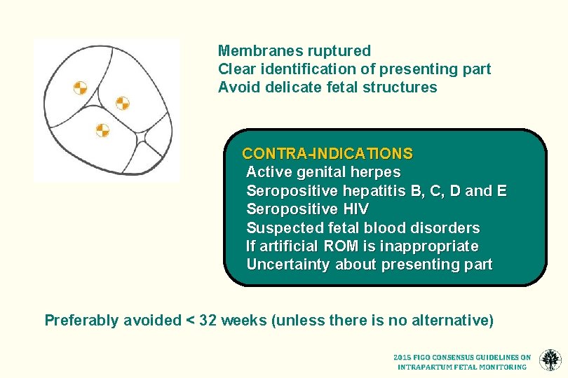 Membranes ruptured Clear identification of presenting part Avoid delicate fetal structures CONTRA-INDICATIONS Active genital