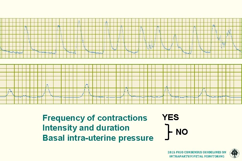 Frequency of contractions Intensity and duration Basal intra-uterine pressure YES NO 2015 FIGO CONSENSUS