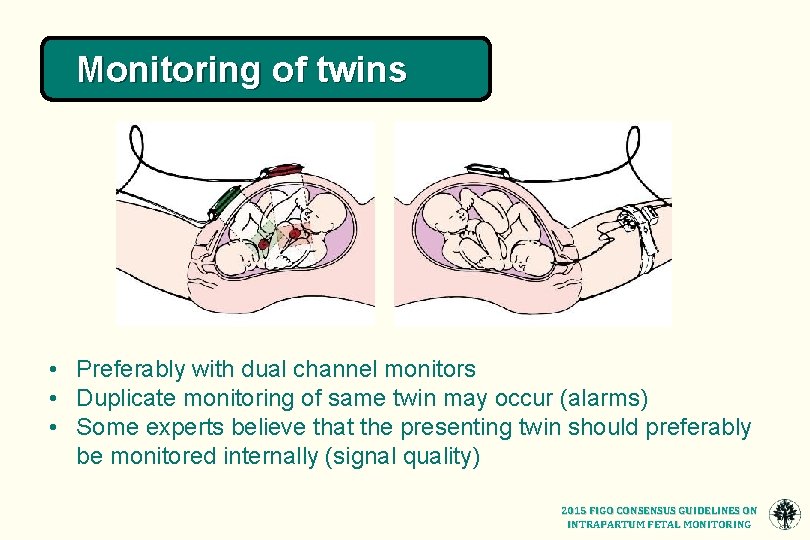 Monitoring of twins • Preferably with dual channel monitors • Duplicate monitoring of same