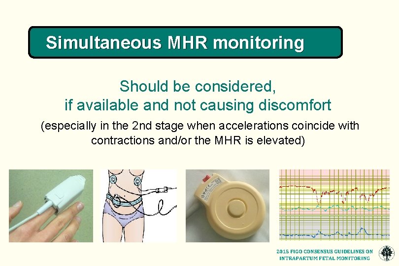 Simultaneous MHR monitoring Should be considered, if available and not causing discomfort (especially in