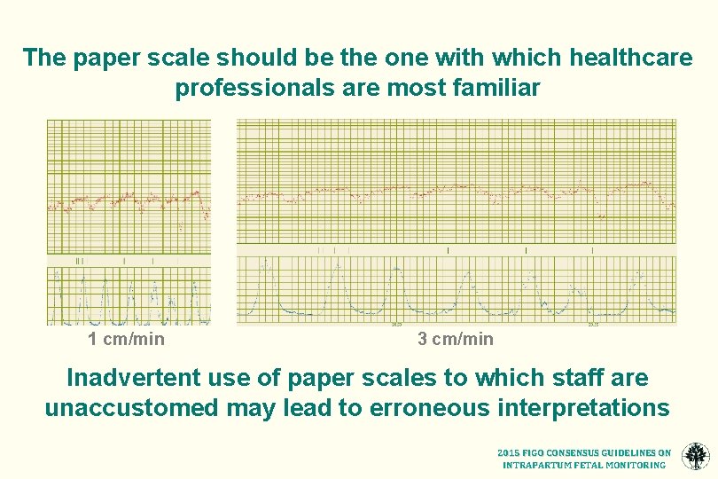 The paper scale should be the one with which healthcare professionals are most familiar