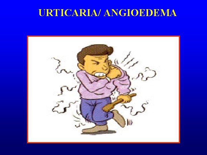 URTICARIA/ ANGIOEDEMA 