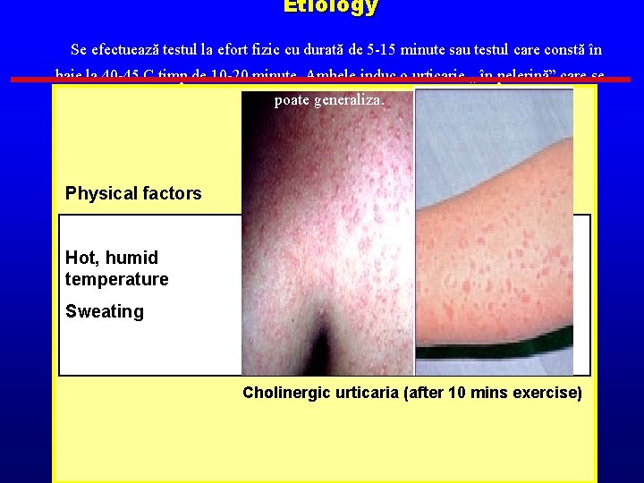 Etiology Se efectuează testul la efort fizic cu durată de 5 -15 minute sau