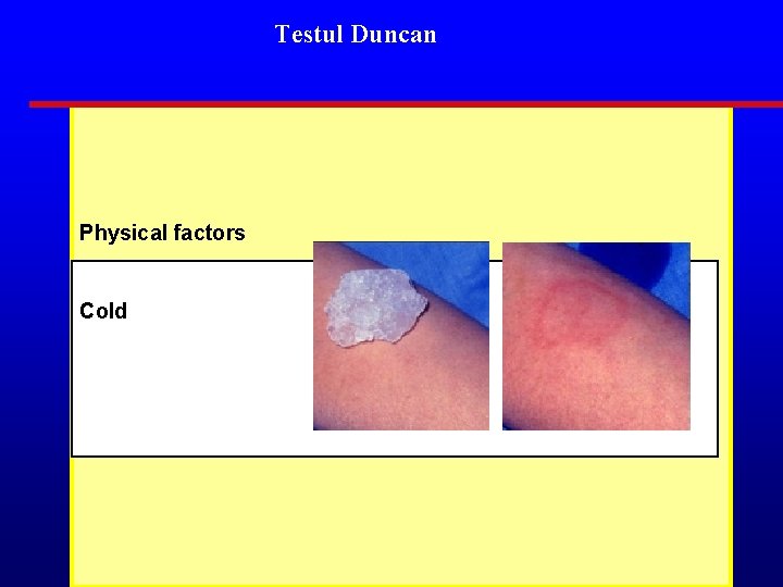 Testul Duncan Physical factors Cold 