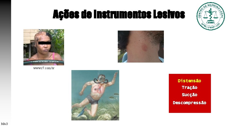 Ações de Instrumentos Lesivos www. r 7. com. br Distensão Tração Sucção Descompressão MAG