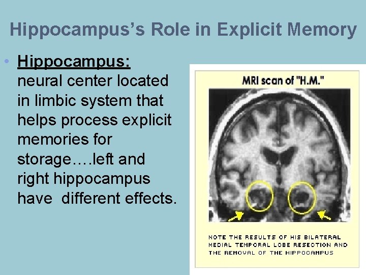 Hippocampus’s Role in Explicit Memory • Hippocampus: neural center located in limbic system that