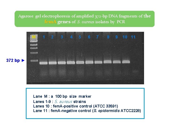 Agarose gel electrophoresis of amplified 372 -bp DNA fragments of the fem. A genes