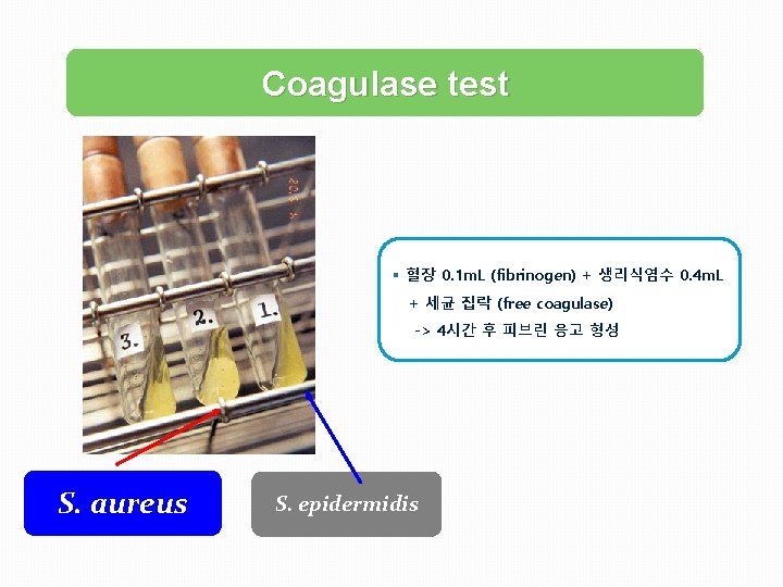 Coagulase test § 혈장 0. 1 m. L (fibrinogen) + 생리식염수 0. 4 m.