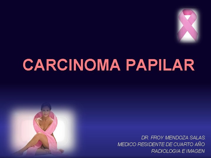 CARCINOMA PAPILAR DR. FROY MENDOZA SALAS. MEDICO RESIDENTE DE CUARTO AÑO RADIOLOGIA E IMAGEN