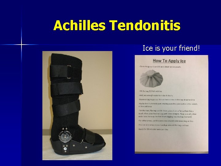 Achilles Tendonitis Ice is your friend! 