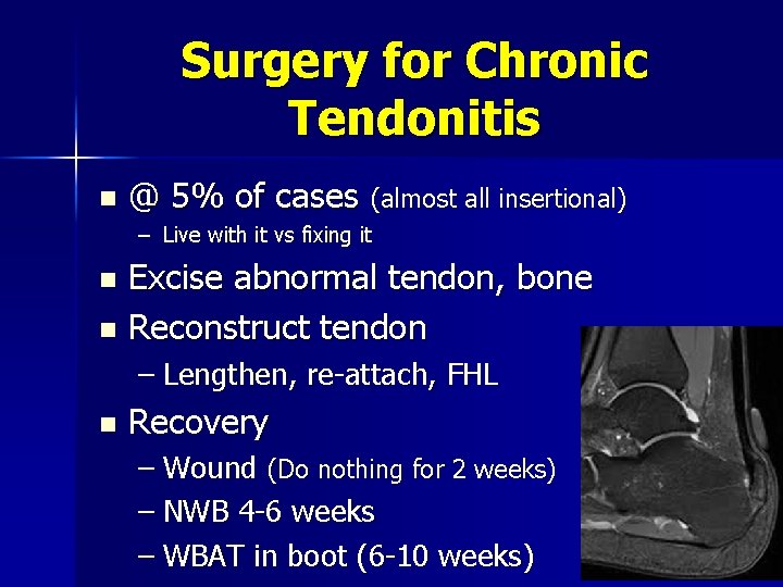 Surgery for Chronic Tendonitis n @ 5% of cases (almost all insertional) – Live