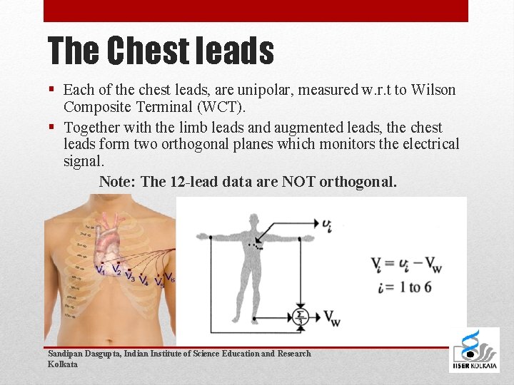 The Chest leads § Each of the chest leads, are unipolar, measured w. r.