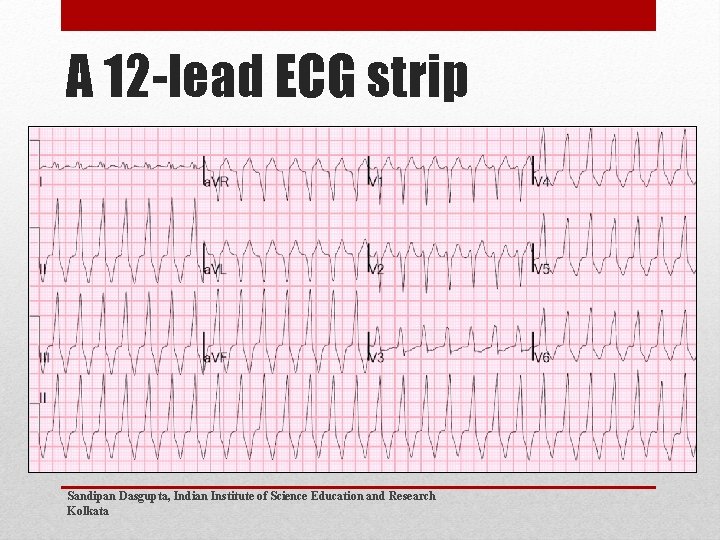 A 12 -lead ECG strip Sandipan Dasgupta, Indian Institute of Science Education and Research A 12 -lead ECG strip Sandipan Dasgupta, Indian Institute of Science Education and Research