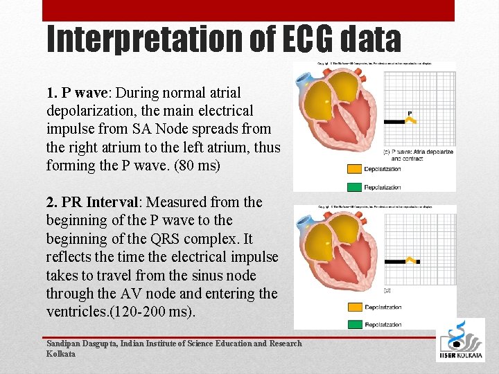 Interpretation of ECG data 1. P wave: During normal atrial depolarization, the main electrical